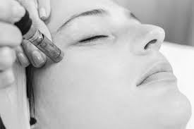 Microneedling Facial Training Course